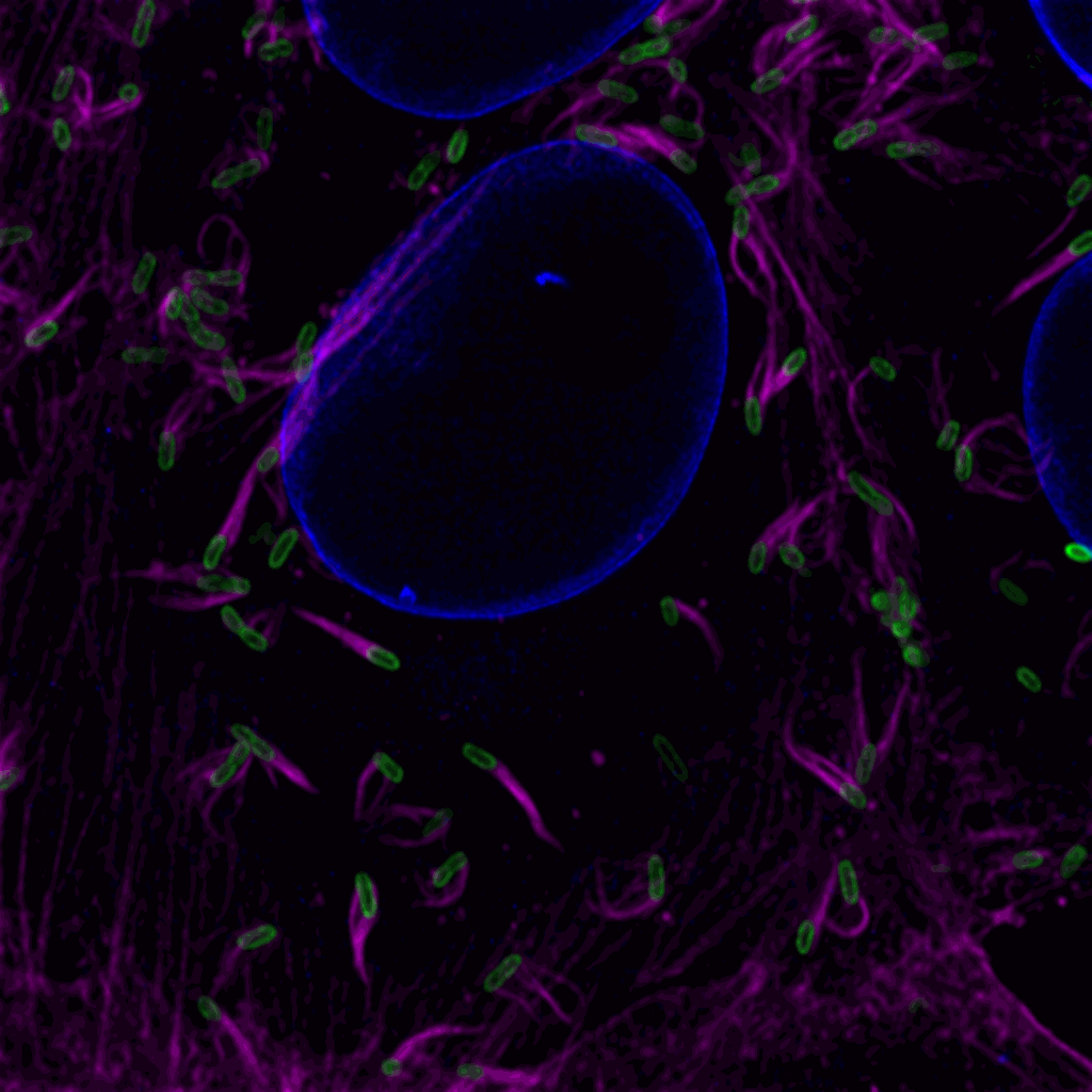 Confocal image of R. rickettsii Sheila Smith (green) producing actin tails (magenta) in Vero host cells (host cell nuclear envelope, blue).