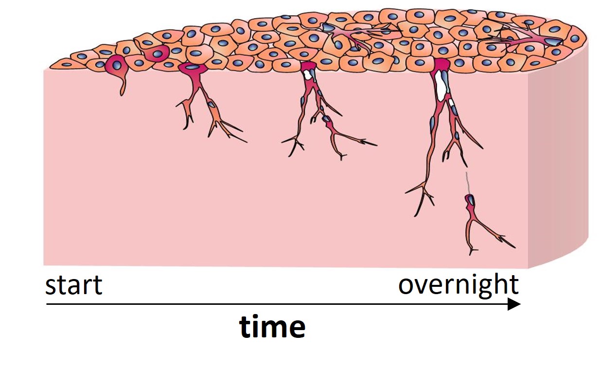 Retinal Angiogenesis
